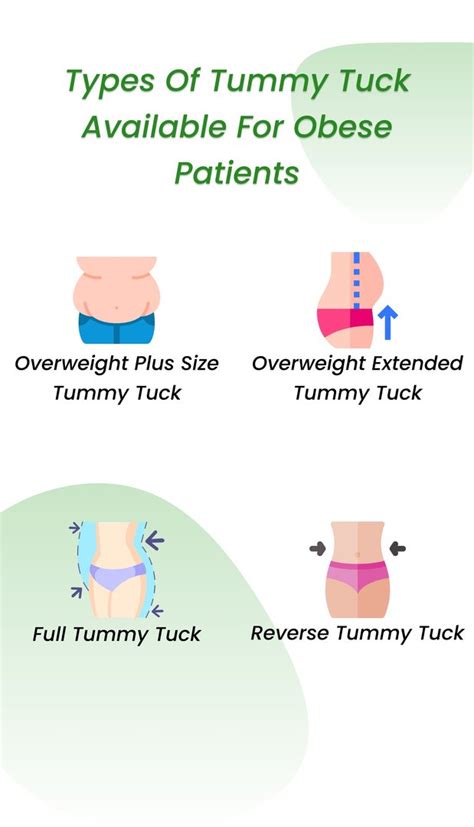 tummy tuck sacramento|plus size tummy tuck sacramento.